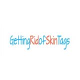 Getting Rid Of Skin Tags