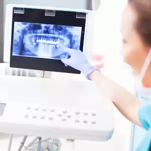 New Rochelle Dental - Valeriy Kanatov DDS